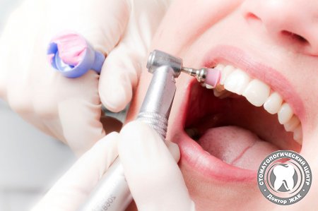 Методы снятия зубных отложений и профилактика