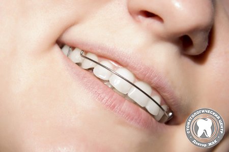 Почему зубы возвращаются в неправильное положение