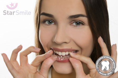 Зубные капы Star Smile в России