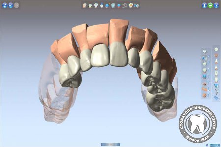 Помощь современных технологий в реставрации зубов
