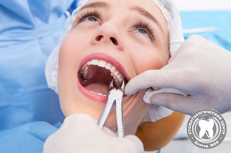 5 мифов об удалении зубов