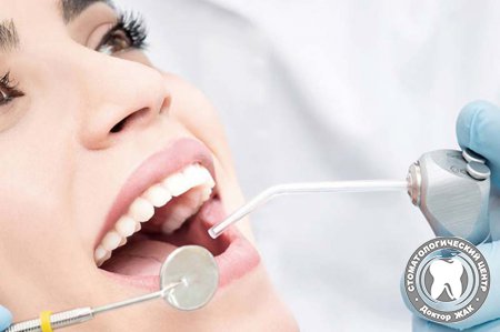 Что такое профессиональная чистка зубов и кому она нужна