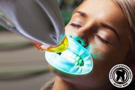 Что такое фотоотбеливание зубов?