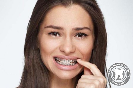 Шаткость зубного ряда при исправлении прикуса: норма или патология?